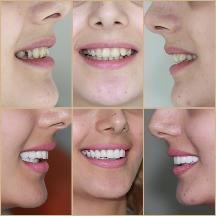smile makeover dentist in istanbul