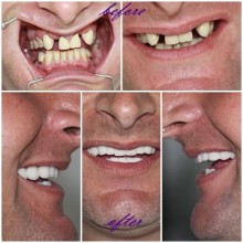 Cosmetic Dentists Istanbul