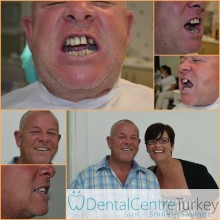 dental treatment in istanbul